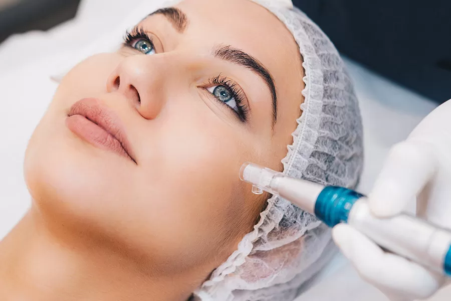 Skin Needling Sydney | Microneedling & Face Needling Treatment | ELC